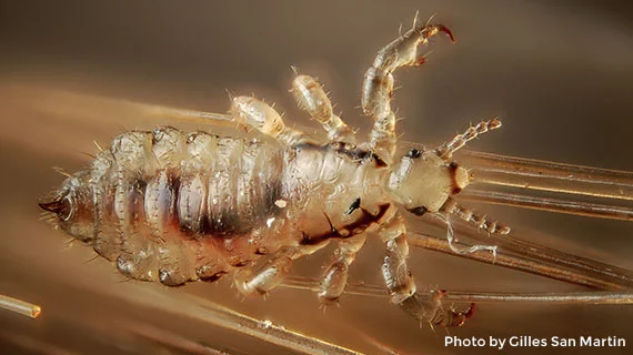 Microscopic view of a louse - Super lice can be killed with dehydration.