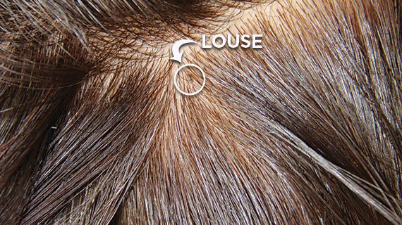 A single adult lice is called a louse.